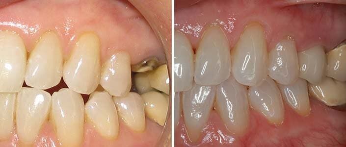 What Everyone Ought To Know About top dental clinic in Dwarka